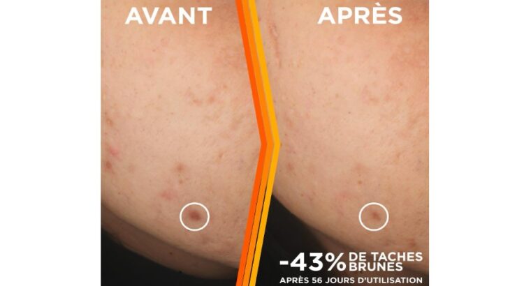 Soin Visage Enrichi En Vitamine C -GARNIER Skin Active – Sérum Éclat – Anti-Tâche Brunes